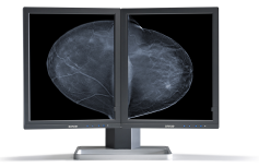 Mammo Tomosynthesis 5MP